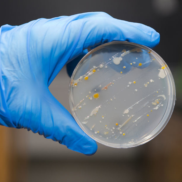 A microbial control program plays a key role in controlling pathogenic microorganisms in food.