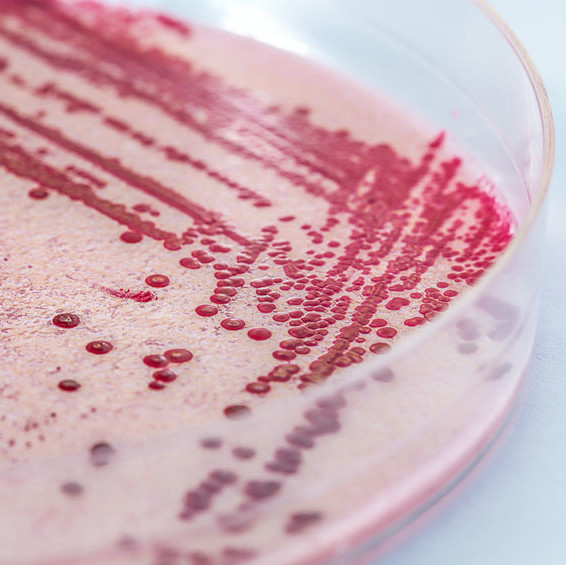 Listeria is a Gram positive, non-spore-forming, motile foodborne pathogen.