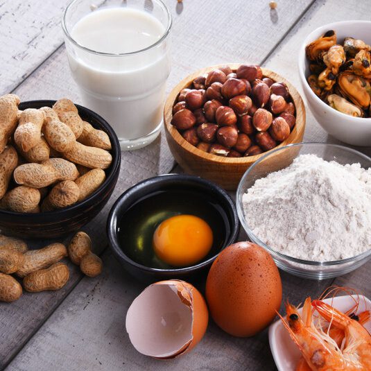 Top Allergens Nuts, fruit, milk, eggs and shellfish are a few common allergens.